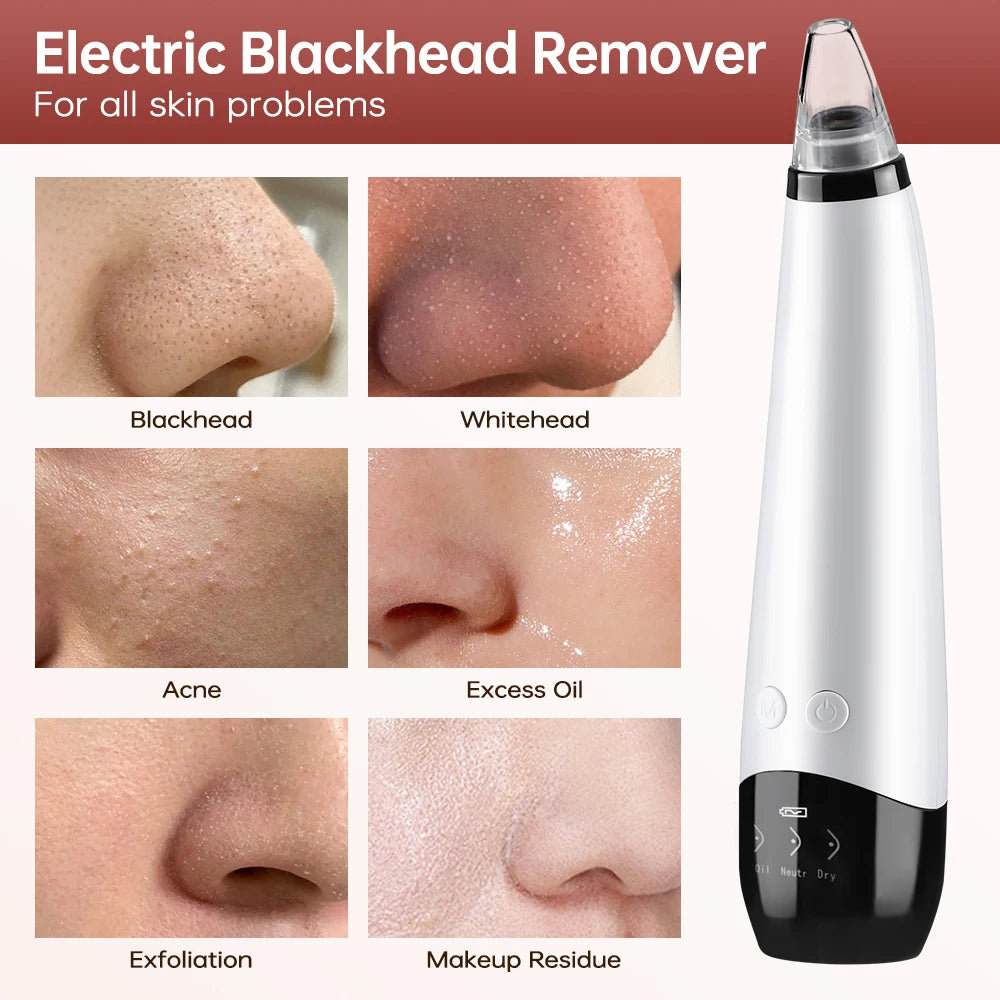 Electric Blackhead Remover Beauty Machine Dead Skin Remover Pore Vacuum Face Cleaner Kit Acne Needle Nose Black Dots Extractor